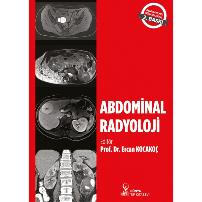 Abdominal Radyoloji 2. Baskı